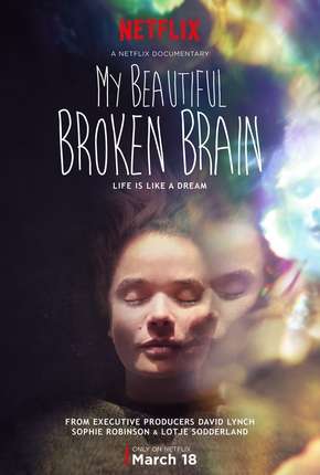 My Beautiful Broken Brain Baixar o Torrent